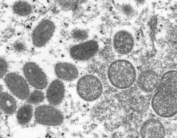 Mature, oval-shaped monkeypox virions, left, and spherical immature virions, right.