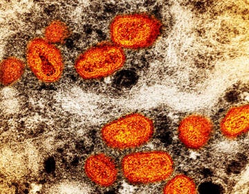 Samples of monkeypox under the view of a microsope.