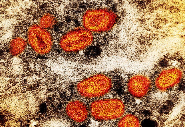 Samples of monkeypox under the view of a microsope.