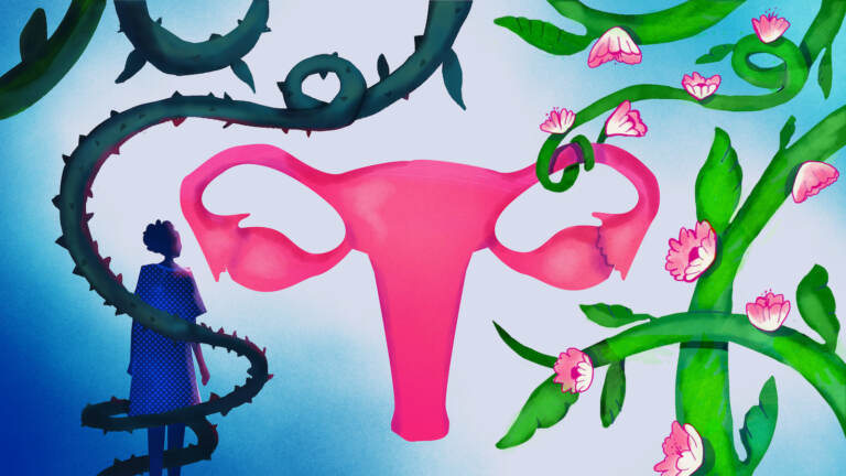 An illustration of fallopian tubes.