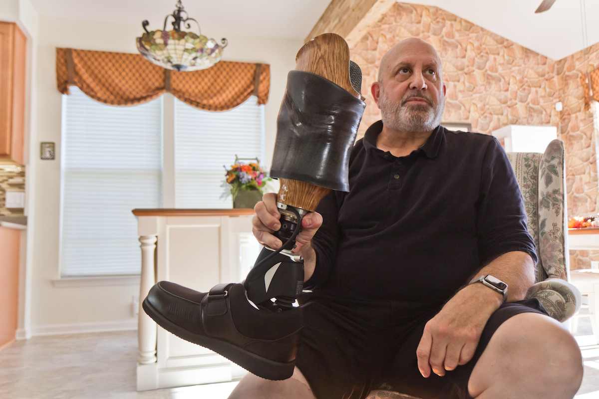 Ed Nathan explains how a compression sleeves holds his prosthetic on at his home in West Chester, Pa. (Kimberly Paynter/WHYY)