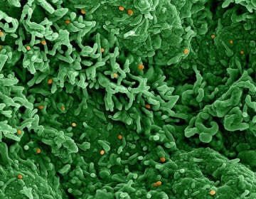 Dots which show the monkeypox virus cells are orange in a sea of green cells that are infected with the virus.