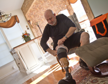Ed Nathan pulls up the liner, socks he uses to protect his leg from rubbing, and the compression sleeve of his prosthetic limb. (Kimberly Paynter/WHYY)