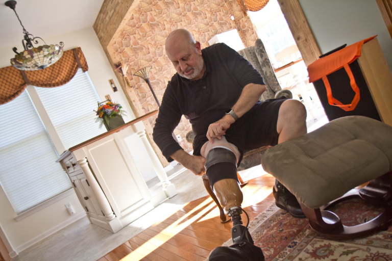 Ed Nathan pulls up the liner, socks he uses to protect his leg from rubbing, and the compression sleeve of his prosthetic limb. (Kimberly Paynter/WHYY)