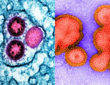 Up-close slides show virus particles.