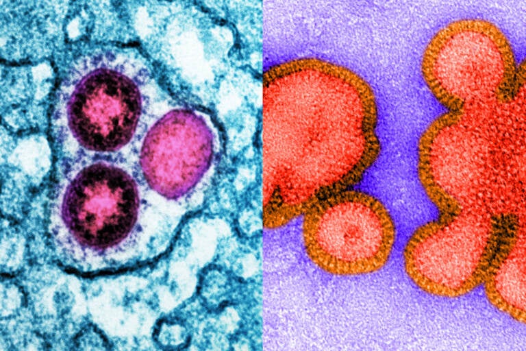 Up-close slides show virus particles.