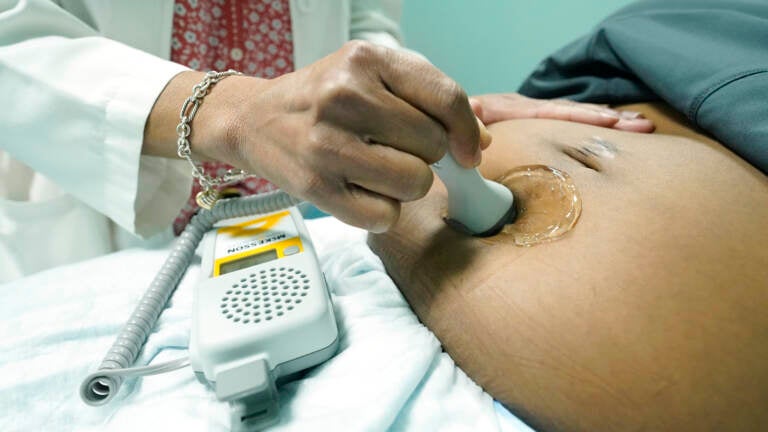 An up-close look at a midwife performing an ultrasound.