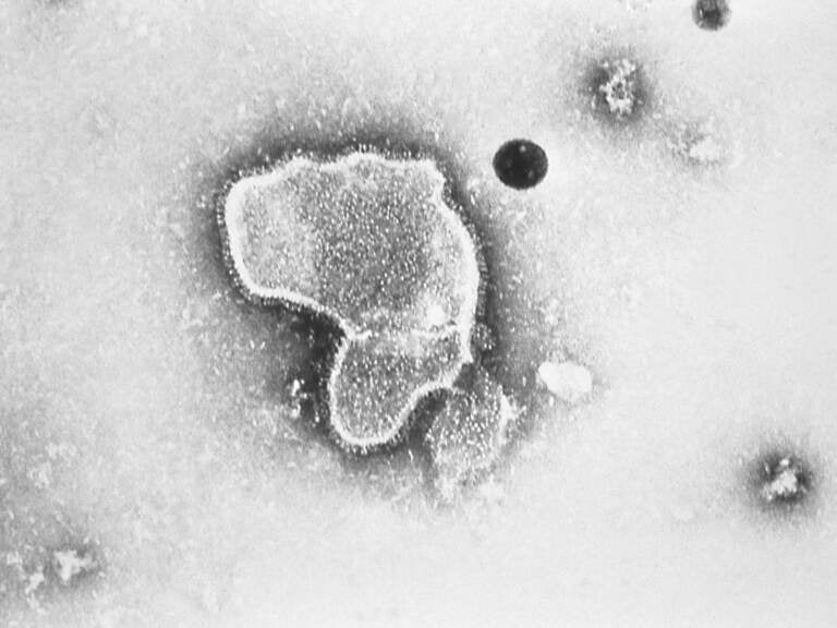 An electron micrograph of Respiratory Syncytial Virus