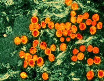 An up-close microscopic image of mpox virus particles.