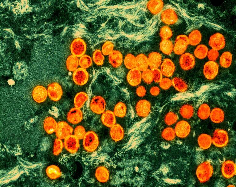 An up-close microscopic image of mpox virus particles.
