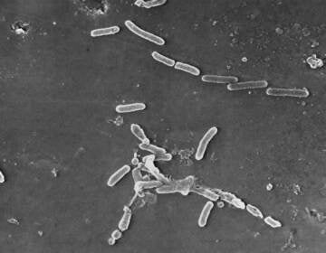 FILE - This scanning electron microscope image made available by the Centers for Disease Control and Prevention shows rod-shaped Pseudomonas aeruginosa bacteria. U.S. health officials are advising people to stop using the over-the-counter eye drops, EzriCare Artificial Tears, that have been linked to an outbreak of drug-resistant infections of Pseudomonas aeruginosa. The Centers for Disease Control and Prevention on Wednesday night, Feb. 1, 2023, sent a health alert to physicians, saying the outbreak includes at least 55 people in 12 states. One died. (Janice Haney Carr/CDC via AP)