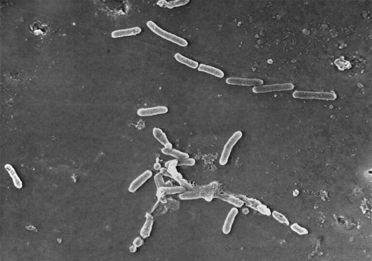 FILE - This scanning electron microscope image made available by the Centers for Disease Control and Prevention shows rod-shaped Pseudomonas aeruginosa bacteria. U.S. health officials are advising people to stop using the over-the-counter eye drops, EzriCare Artificial Tears, that have been linked to an outbreak of drug-resistant infections of Pseudomonas aeruginosa. The Centers for Disease Control and Prevention on Wednesday night, Feb. 1, 2023, sent a health alert to physicians, saying the outbreak includes at least 55 people in 12 states. One died. (Janice Haney Carr/CDC via AP)