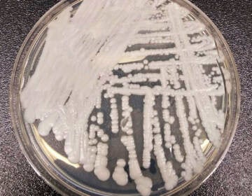 This undated photo made available by the Centers for Disease Control and Prevention shows a strain of Candida auris cultured in a petri dish