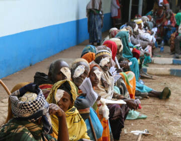 A row of people await check-up from cataract surgery