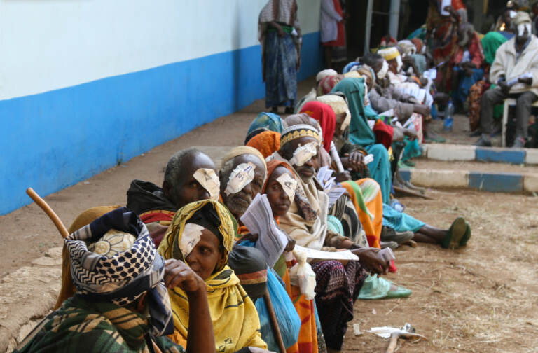 A row of people await check-up from cataract surgery