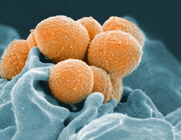 This handout image provided by the National Institute of Allergy and Infectious Diseases shows an electron microscope image of Group A Streptococcus (orange) during phagocytic interaction with a human neutrophil (blue)