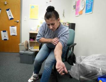 Amy Treglia shows scarring on her arm.