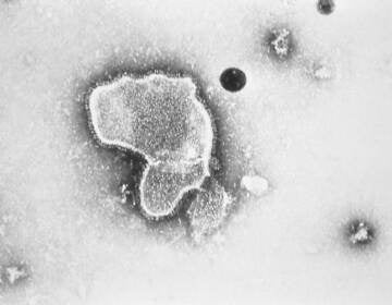 An electron micrograph of Respiratory Syncytial Virus, also known as RSV, which is the leading cause of hospitalizations among infants in the U.S.