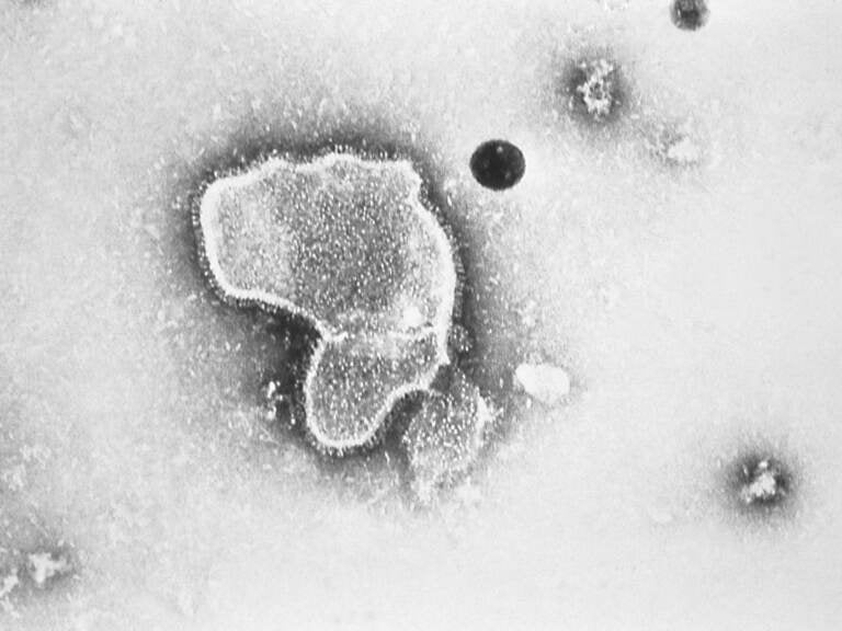 An electron micrograph of Respiratory Syncytial Virus, also known as RSV, which is the leading cause of hospitalizations among infants in the U.S.