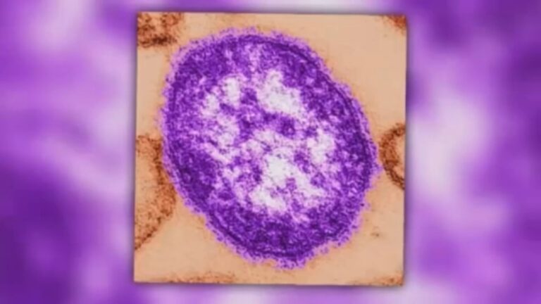 Measles virus under microscope