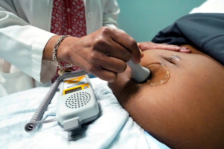A doctor uses a hand-held Doppler probe on a pregnant woman