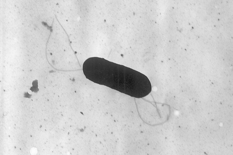 Listeria under a microscope