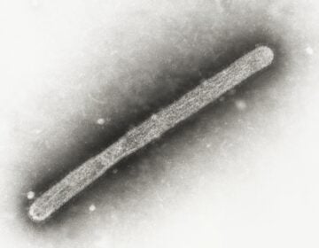 an electron microscope image shows an avian influenza A H5N1 virion