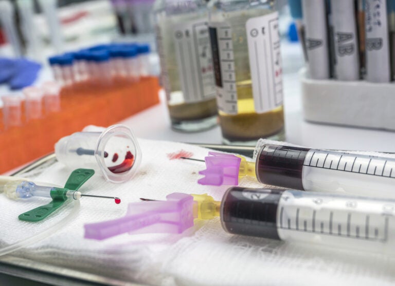 Needles and bottles for sampling blood cultures