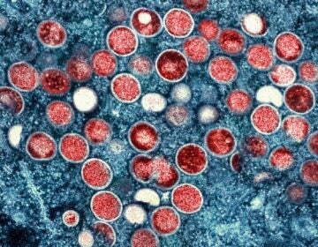 This undated image provided by the National Institute of Allergy and Infectious Diseases shows a colorized transmission electron micrograph of mpox particles (red) found within an infected cell (blue), cultured in the laboratory that was captured and color-enhanced at the NIAID Integrated Research Facility in Fort Detrick, Md.