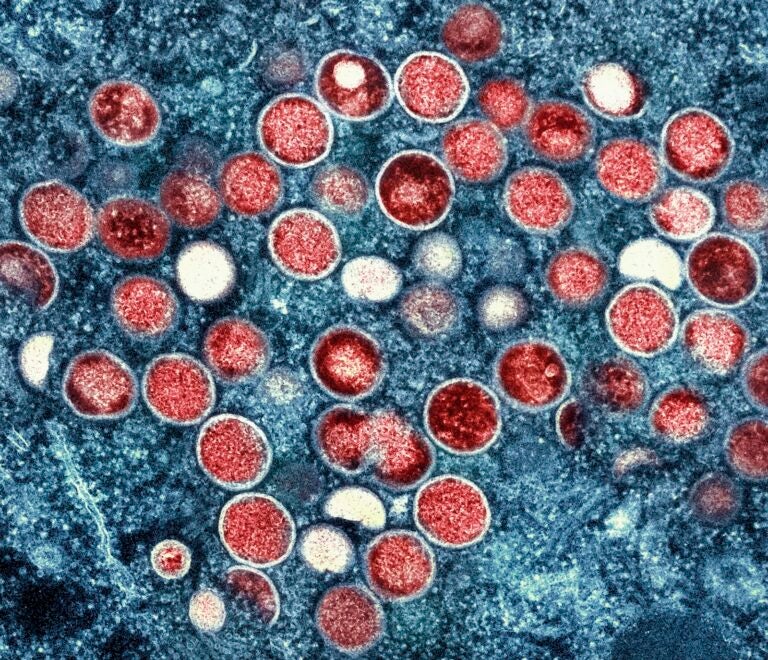 This undated image provided by the National Institute of Allergy and Infectious Diseases shows a colorized transmission electron micrograph of mpox particles (red) found within an infected cell (blue), cultured in the laboratory that was captured and color-enhanced at the NIAID Integrated Research Facility in Fort Detrick, Md.