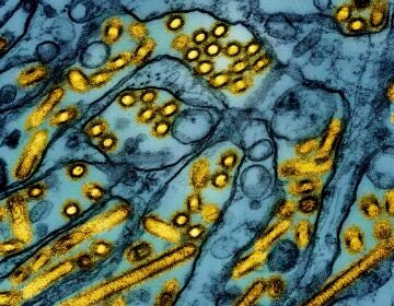 This colorized electron microscope image released by the National Institute of Allergy and Infectious Diseases on March 26, 2024, shows avian influenza A H5N1 virus particles (yellow), grown in Madin-Darby Canine Kidney (MDCK) epithelial cells (blue).