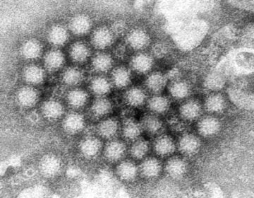 This electron microscope image provided by the Centers for Disease Control and Prevention shows a cluster of norovirus virions.