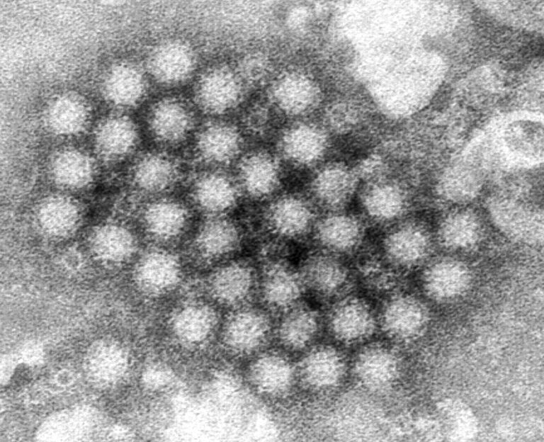 This electron microscope image provided by the Centers for Disease Control and Prevention shows a cluster of norovirus virions.