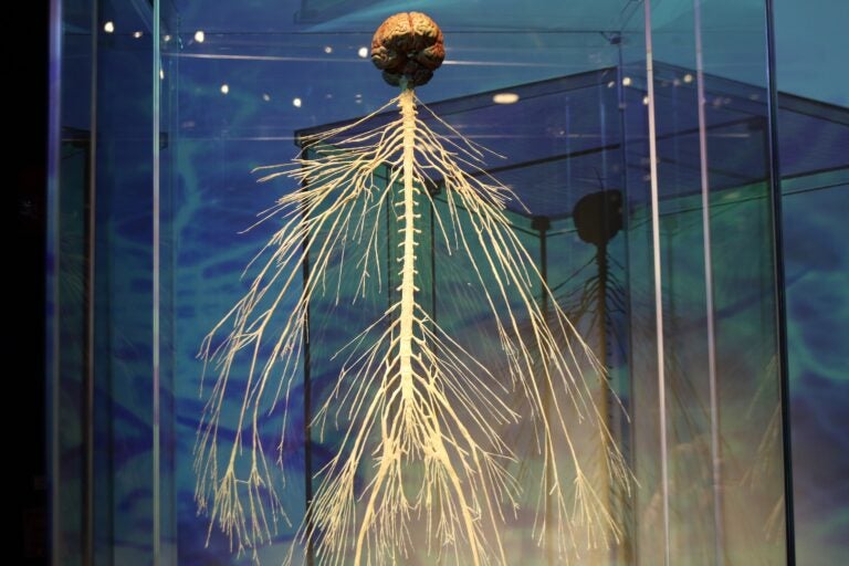 a close-up of a plastinate of skeletal fibers