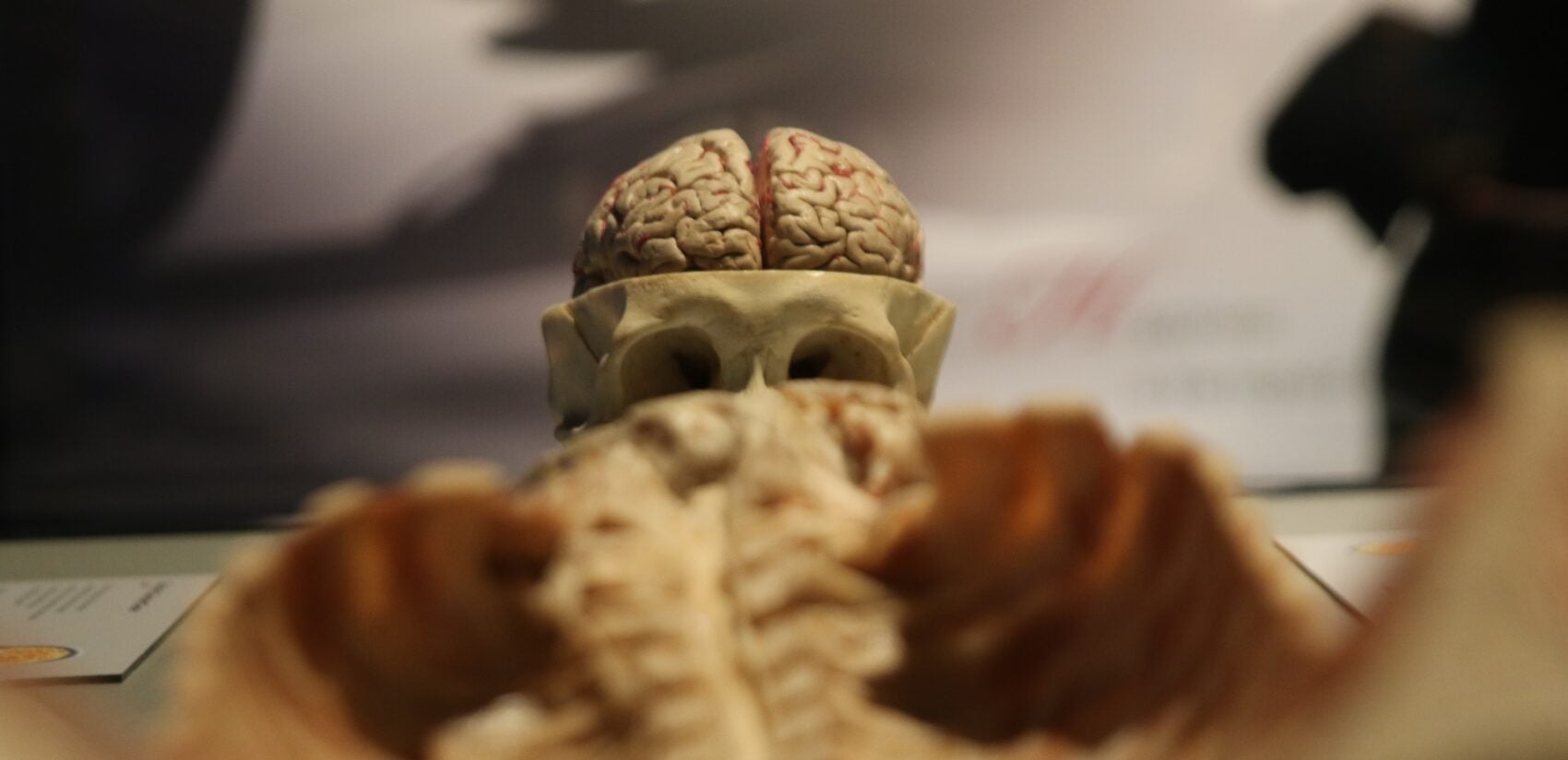 a close-up of a plastinate of a brain