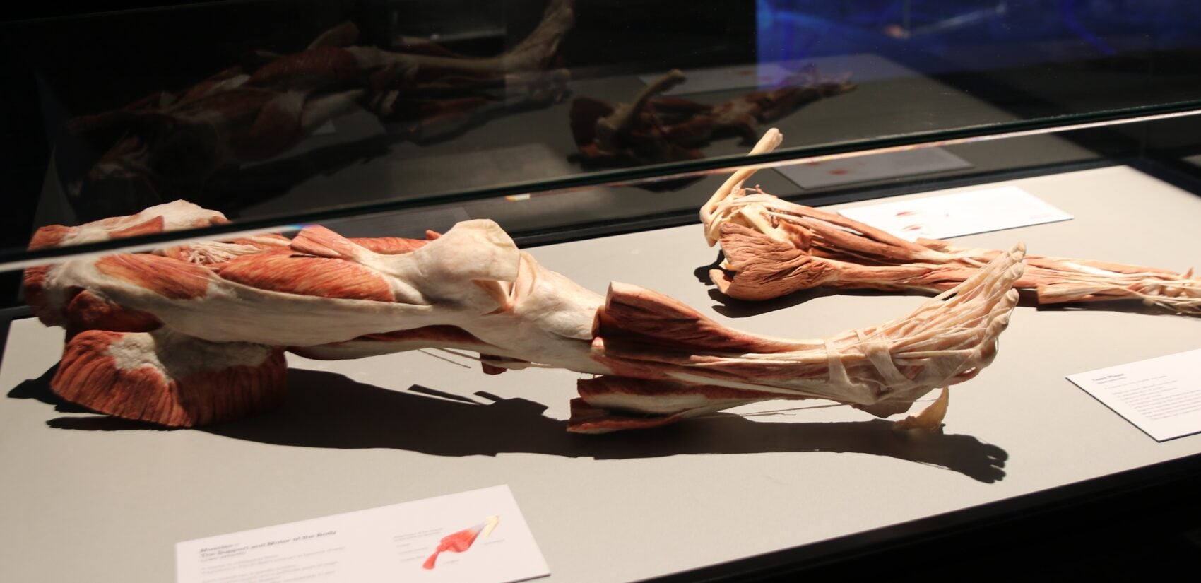 a plastinate of a leg