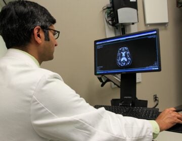 A doctor reviews an MRI
