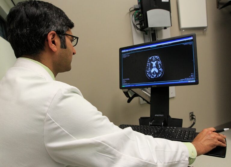 MRI-doctor-file-AP A doctor reviews an MRI