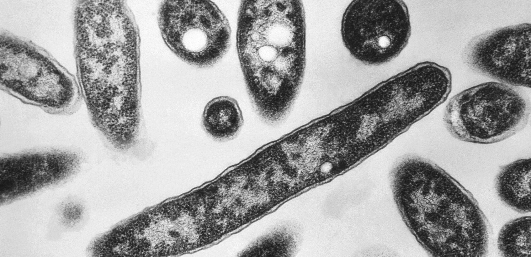 Legionnaire’s Explainer Legionella pneumophila bacteria