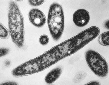 Legionella pneumophila bacteria