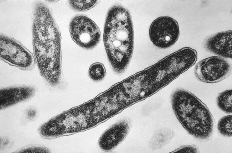Legionnaire’s Explainer Legionella pneumophila bacteria