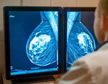 Penn Researchers offer hope thanks to a major discovery on how to identify so-called cancer sleeper cells. Are we getting closer to a cure?
