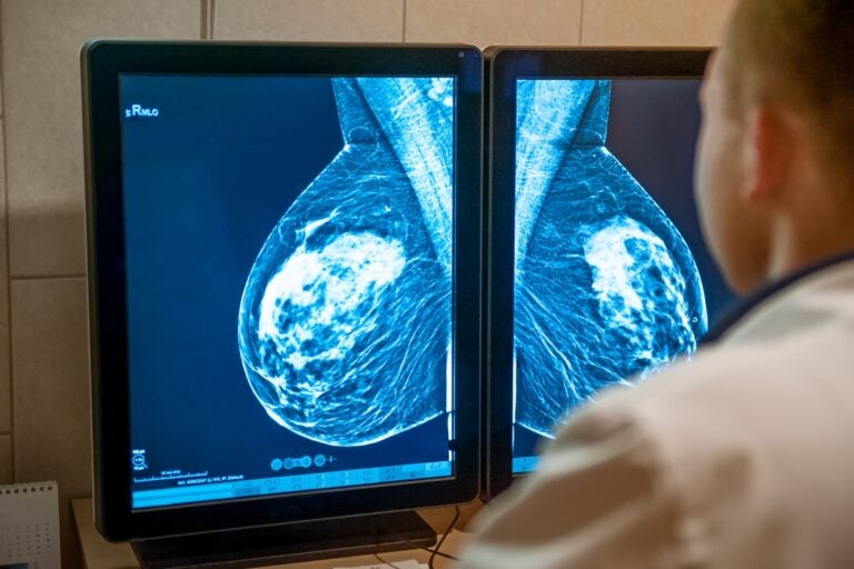 Penn Researchers offer hope thanks to a major discovery on how to identify so-called cancer sleeper cells. Are we getting closer to a cure?