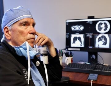 2025 10 21-e lee-gerard criner-philadelphia temple lung center-AI ct scans Dr. Gerard Criner, director of Temple Lung Center