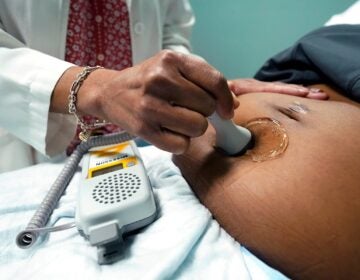 Climate Heat Farmworkers Pregnancy Takeaways A doctor uses a hand-held Doppler probe on a pregnant woman