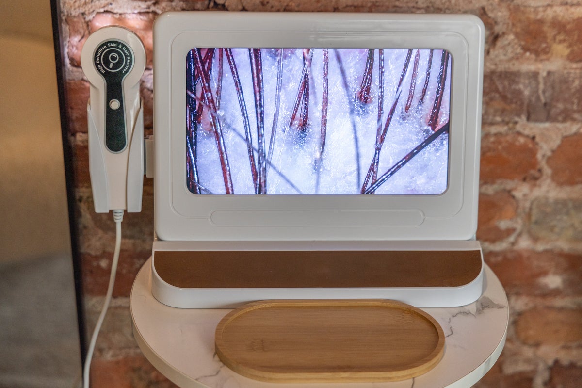 A close-up image of a scalp