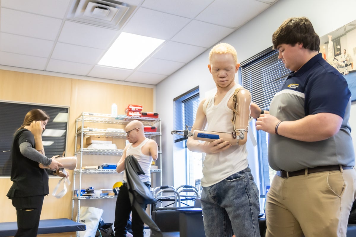 After surviving violent attacks and amputation, Tanzanians with albinism get new prosthetics in New Jersey