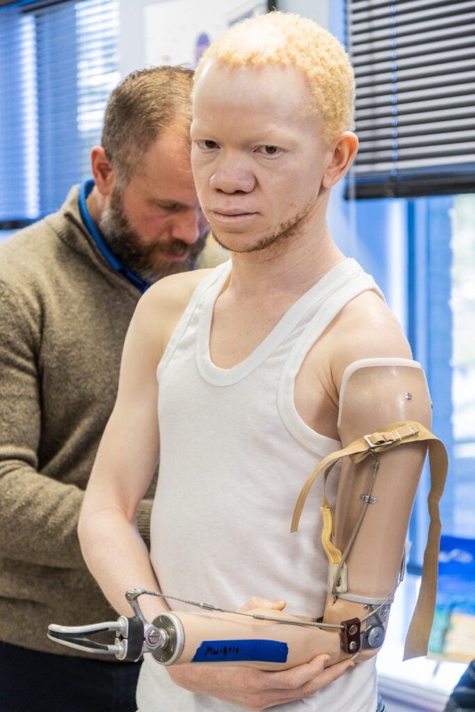 Mwigulu holds onto his newly attached prosthetic left arm with his right arm.