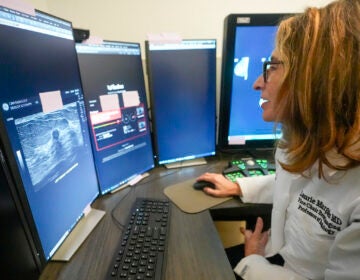 AI Doctors Versus Algorithms A doctor uses breast imaging AI to get a second opinion on mammography ultrasounds. (AP Photo/Mary Altaffer)