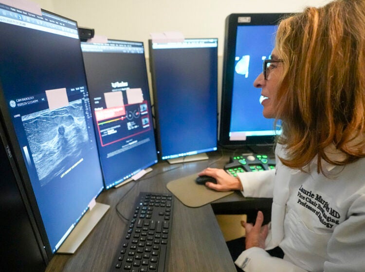 A doctor uses breast imaging AI to get a second opinion on mammography ultrasounds. (AP Photo/Mary Altaffer)